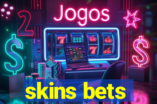 skins bets